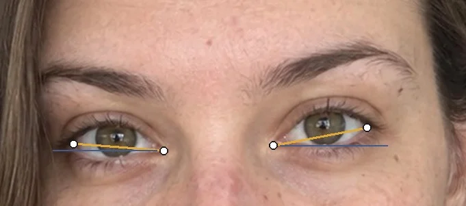 Her eyes with the corner-to-corner tilt lines drawn