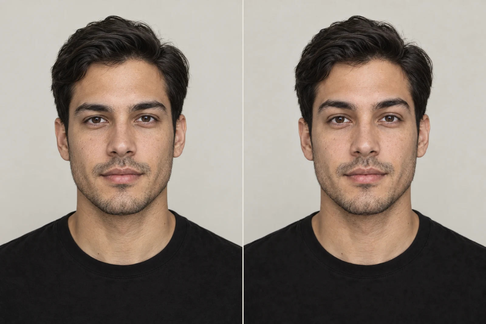 At rest (left), brows lifted about 3 mm (right).